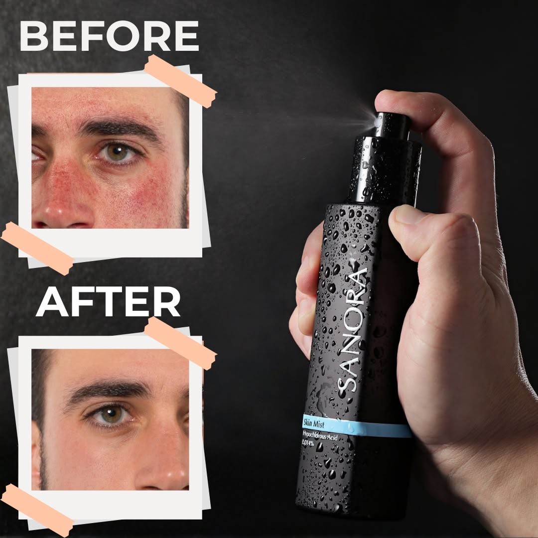 SANORA Post-Workout Face Mist