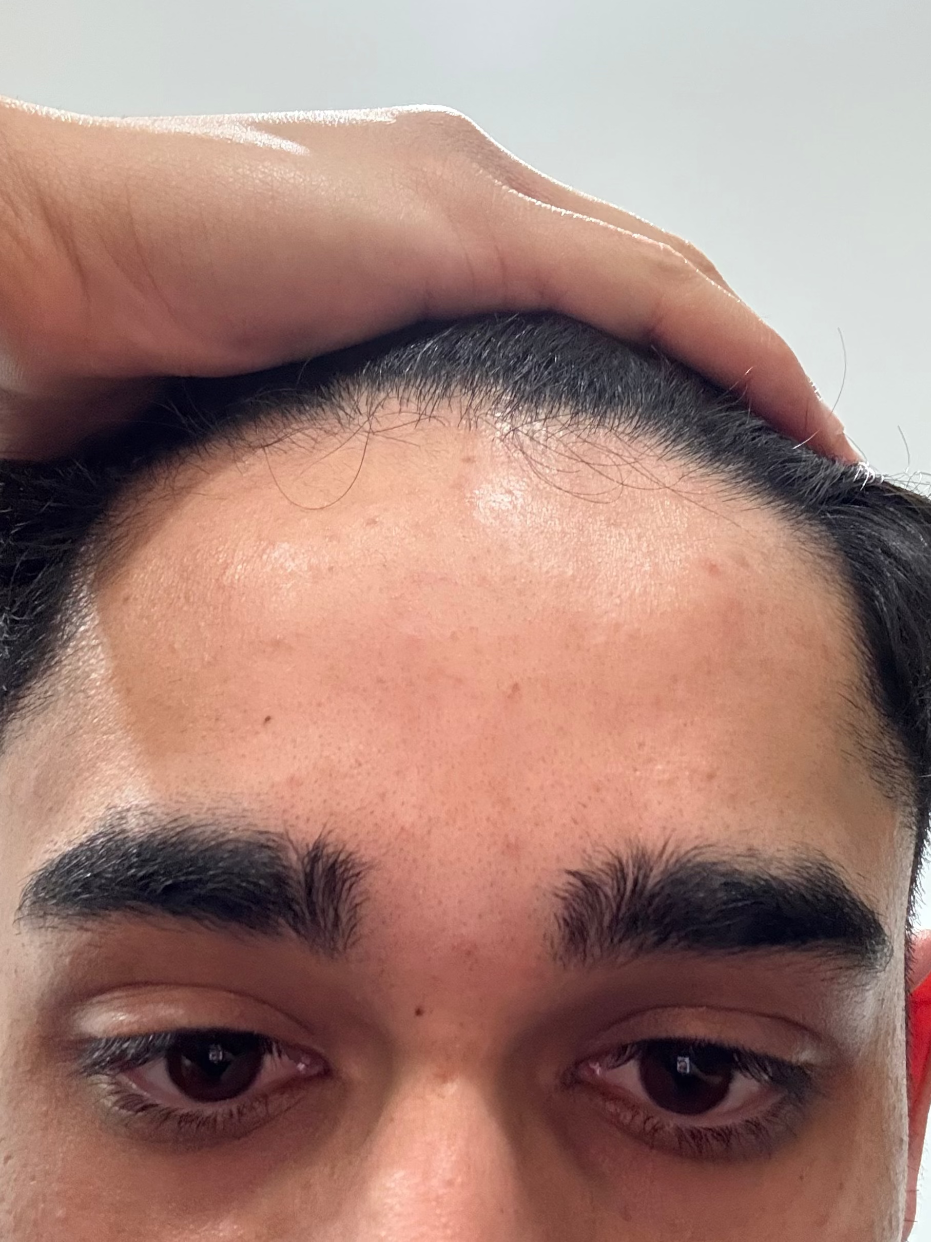 After