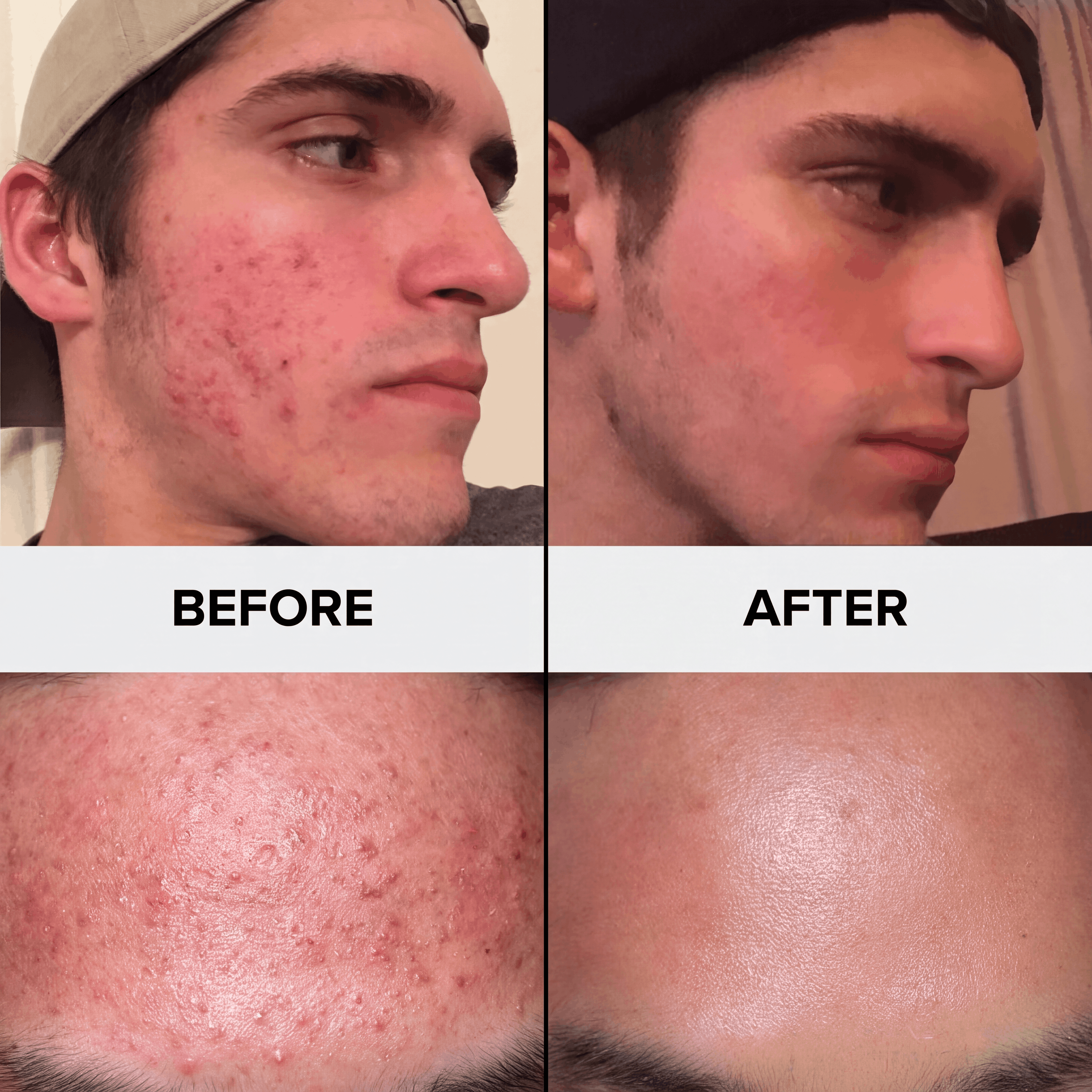SANORA Post-Workout Face Mist
