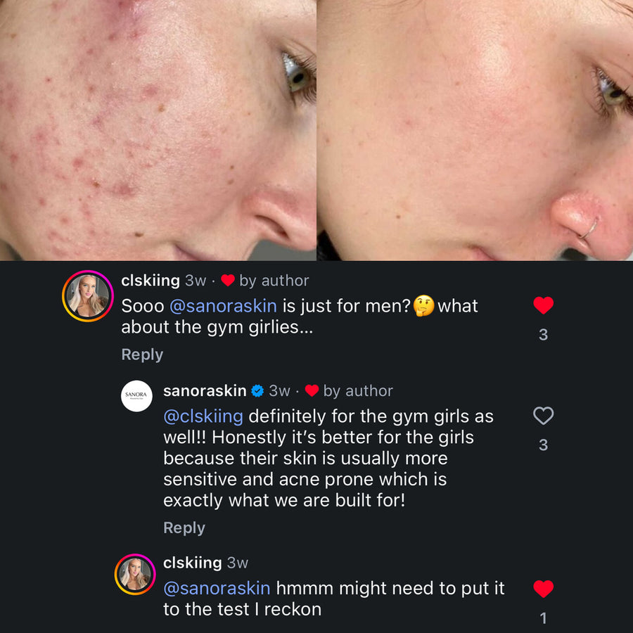 Female customer before and after, cheek